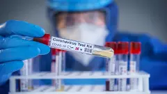 India logs 12,591 new Covid cases in a day, highest in around 8 months