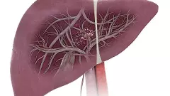 World Liver Day: Be vigilant, do regular liver check-up, fatty liver can affect anyone